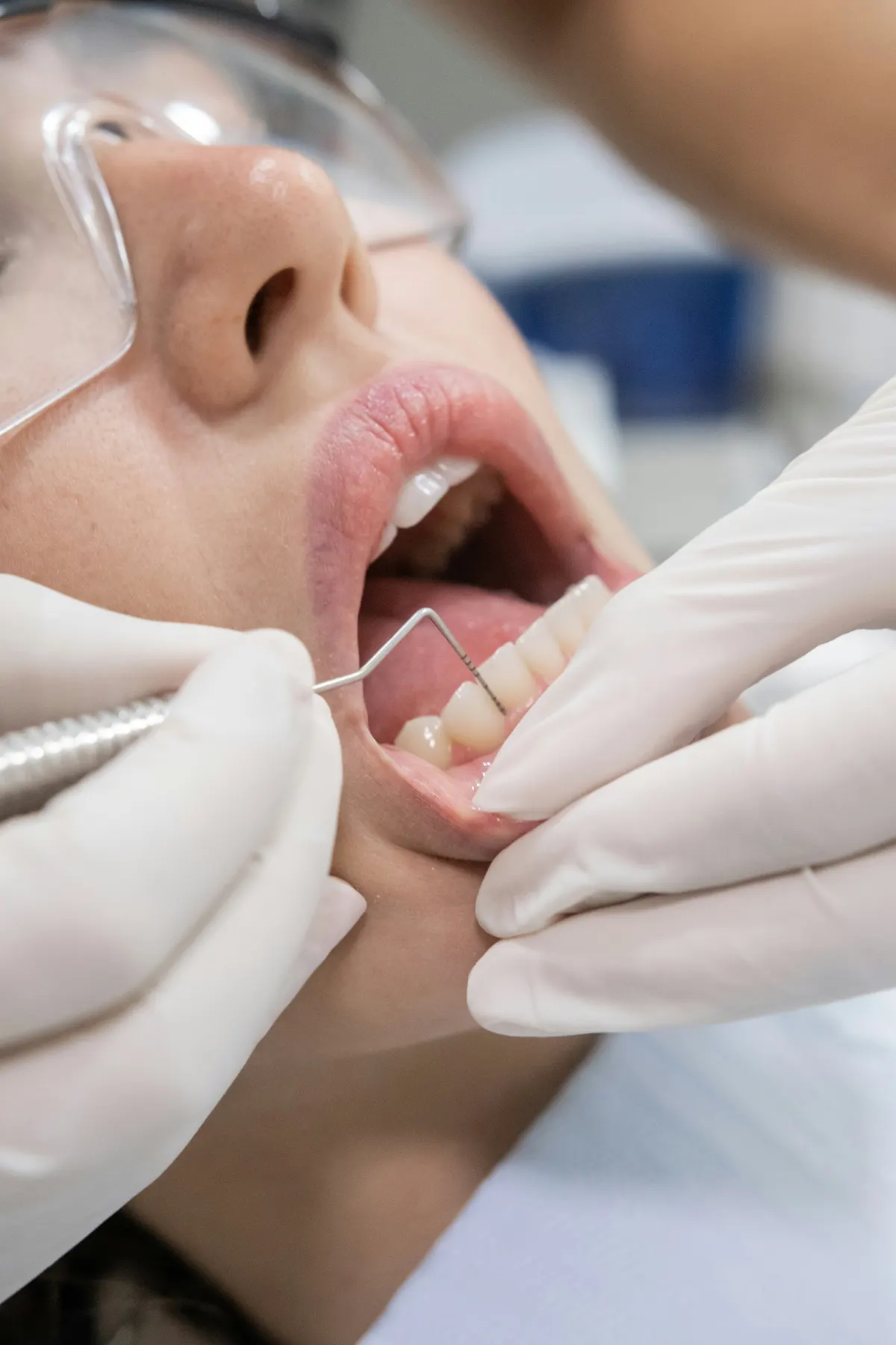Close-up of a gentle periodontal gum examination at Power Smile Dental Centre